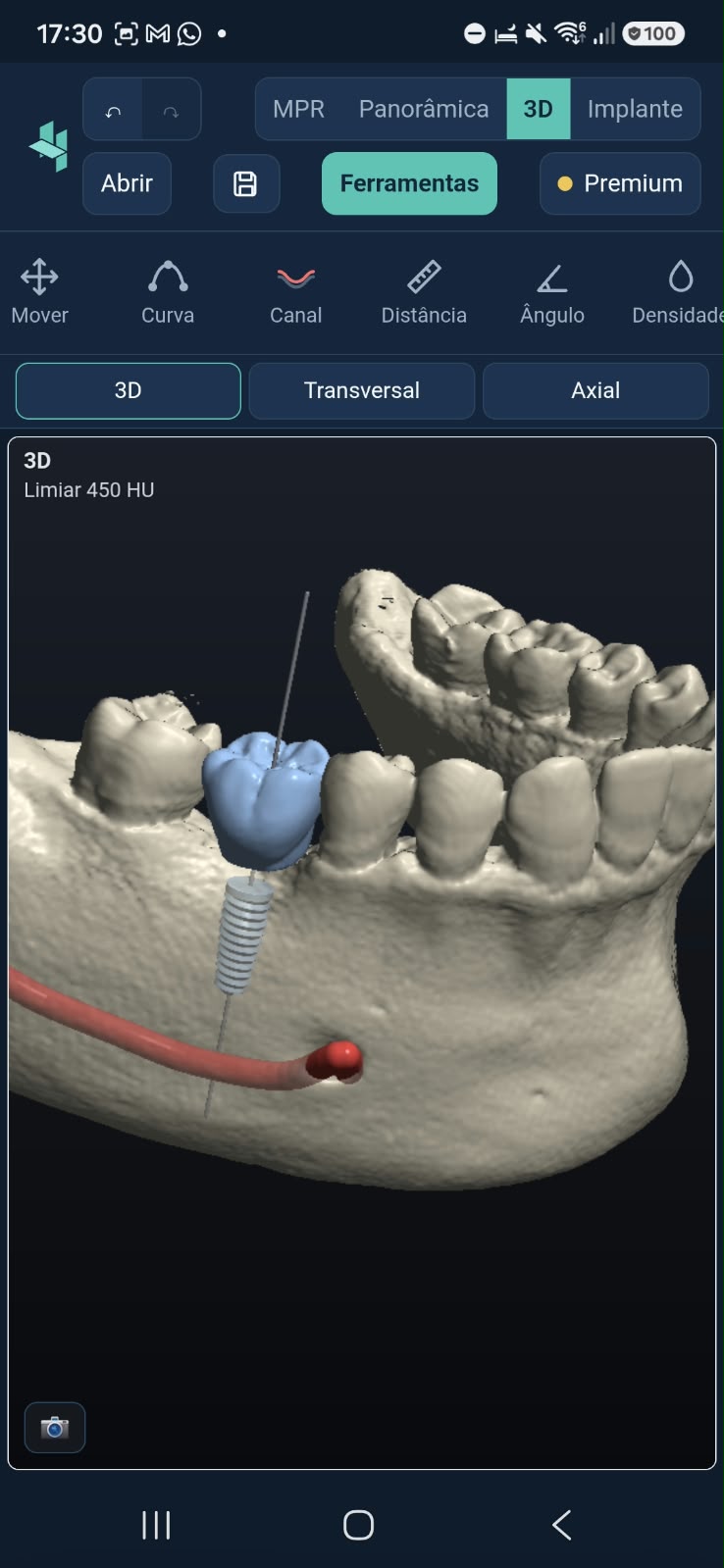 Volume em 3D